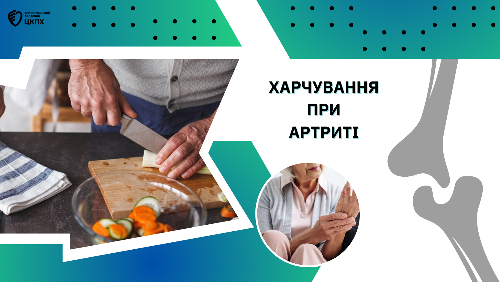 🥗 Харчування при артриті