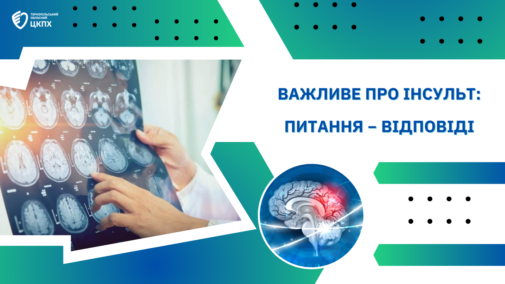 💁‍♀️ Важливе про інсульт: питання − відповіді