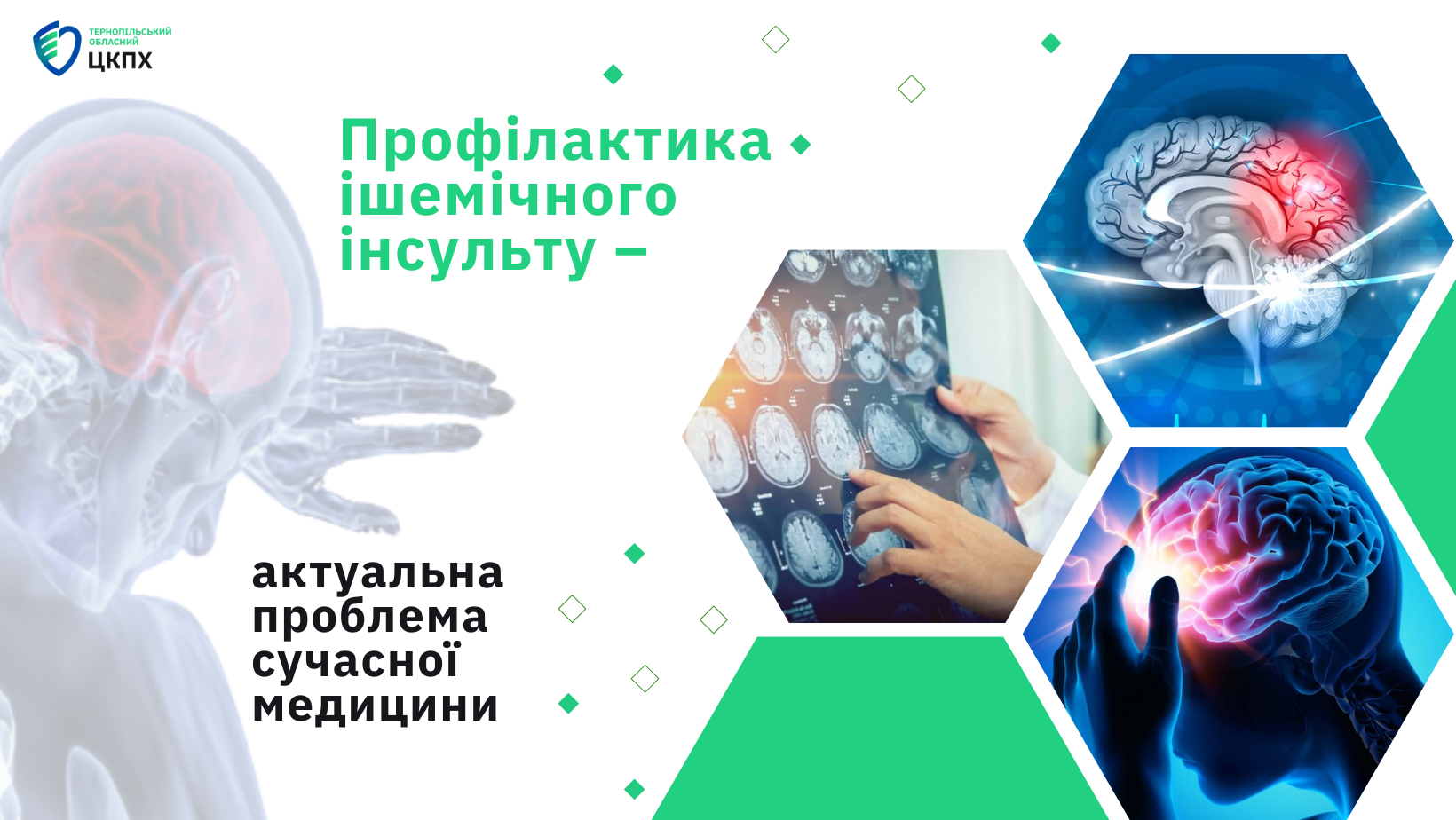 📝 Профілактика ішемічного інсульту – актуальна проблема сучасної медицини