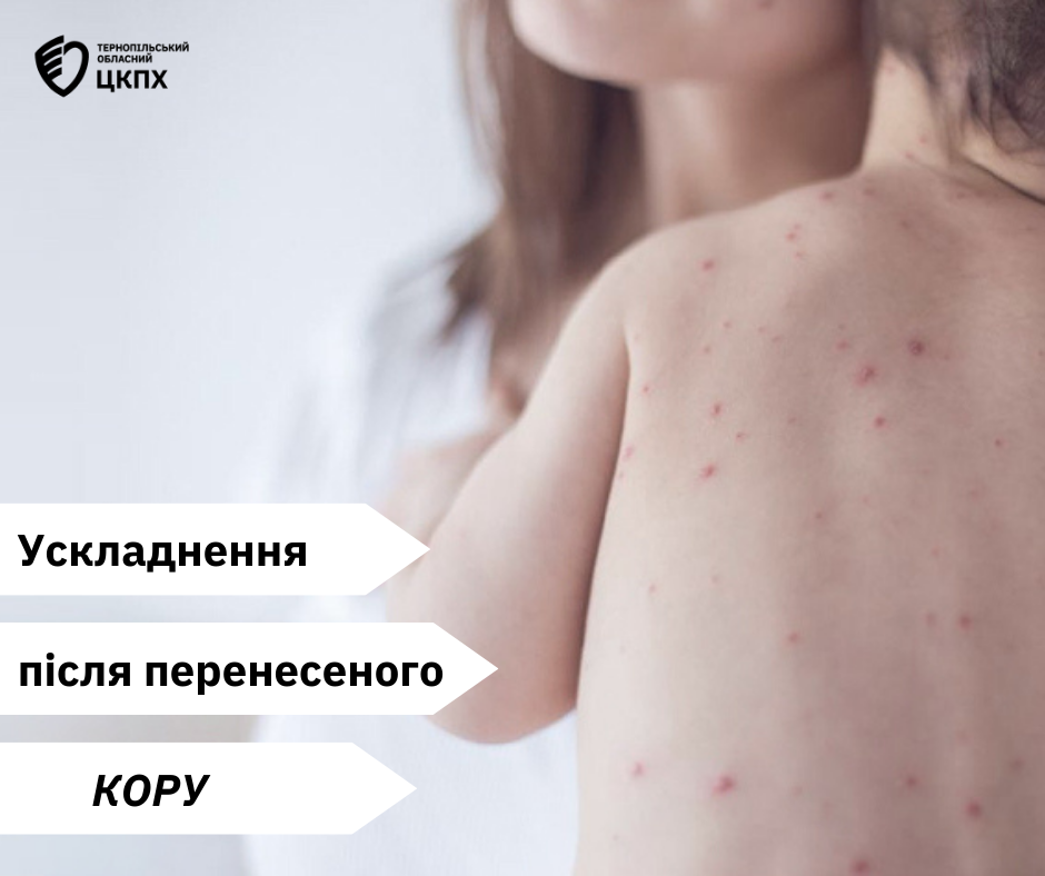 👩‍⚕️ Ускладнення після перенесеного  кору