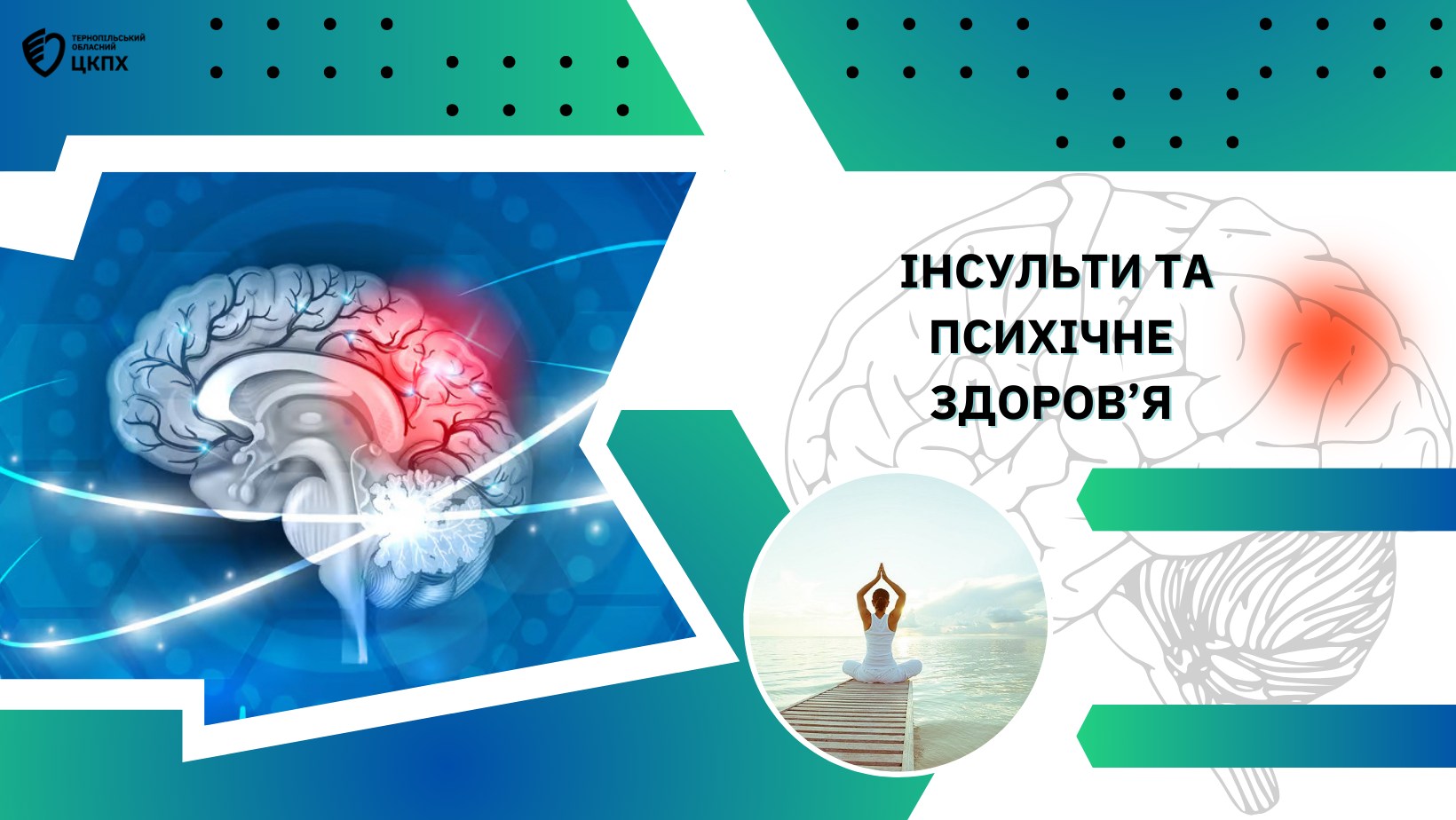 🧠 Інсульти та психічне здоров'я