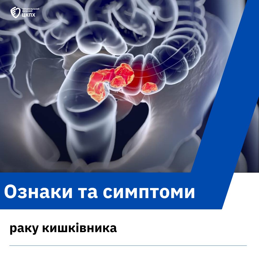 👩‍⚕️Ознаки та симптоми раку кишківника