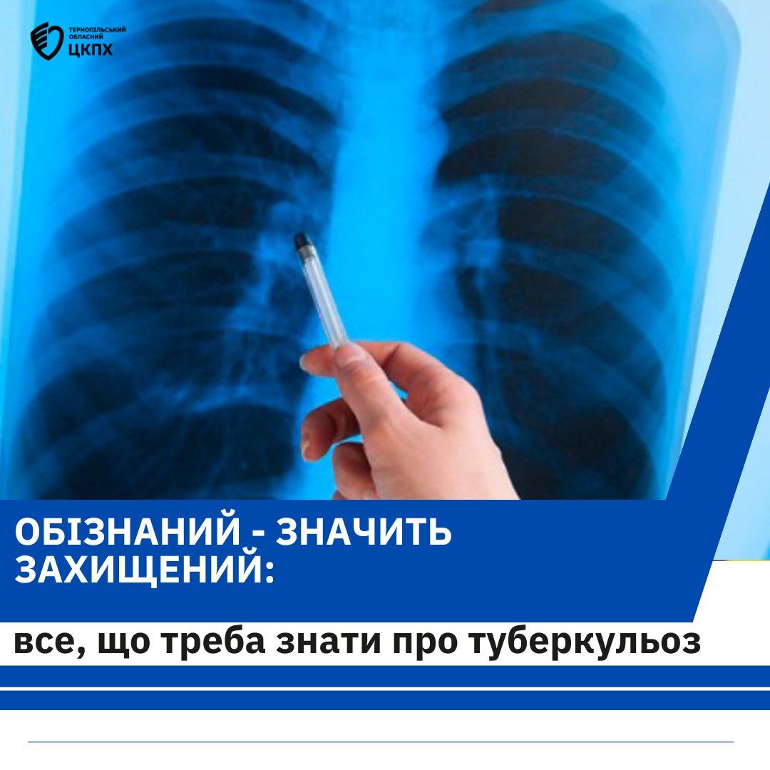 👩‍⚕️ОБІЗНАНИЙ - ЗНАЧИТЬ ЗАХИЩЕНИЙ: ВСЕ, ЩО ТРЕБА ЗНАТИ ПРО ТУБЕРКУЛЬОЗ 