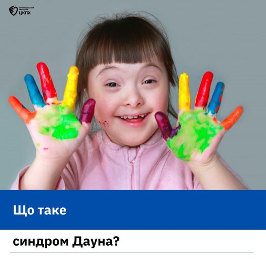 🤔Що таке синдром Дауна❓