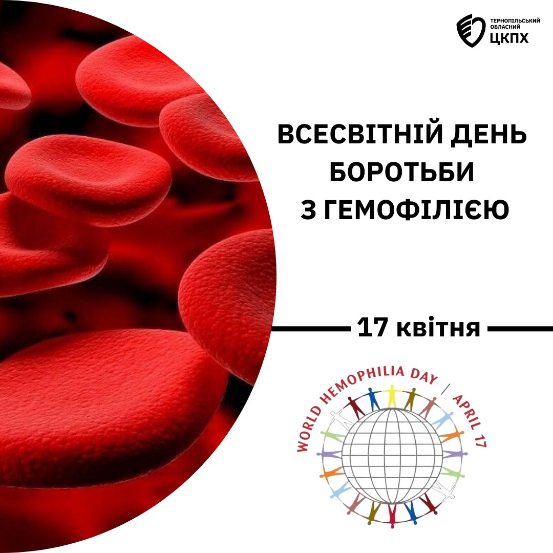 17 квітня − Всесвітній день боротьби з гемофілією