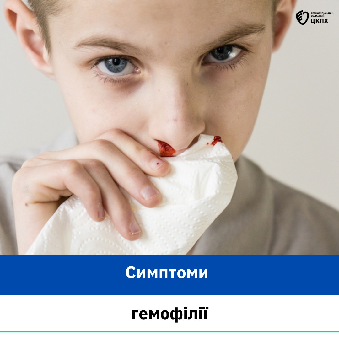 👩‍⚕️Симптоми гемофілії