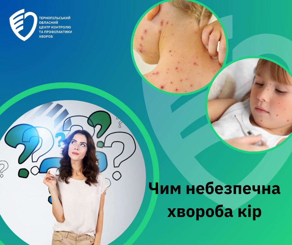 🤔 Чим небезпечна хвороба кір❓