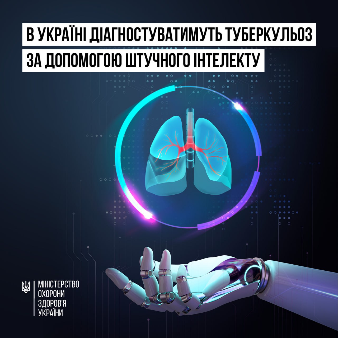 В Україні діагностуватимуть туберкульоз за допомогою штучного інтелекту